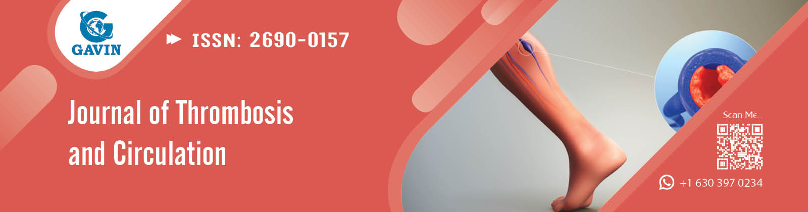 Journal of Thrombosis and Circulation